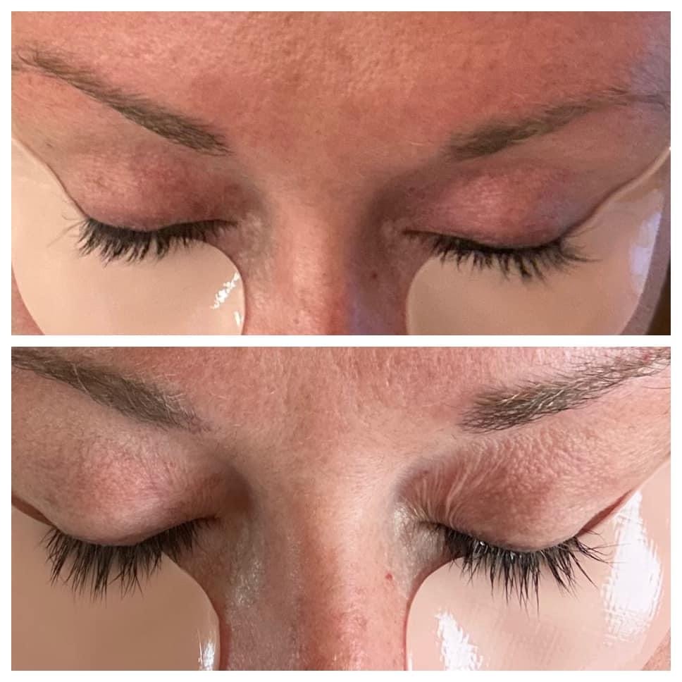 Before and After Comparison for the Lash & Brow Serum